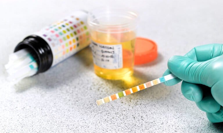 Jak zdać test na obecność narkotyków: Pracodawcy wciąż testują ludzi pod kątem marihuany - MEDCAN24