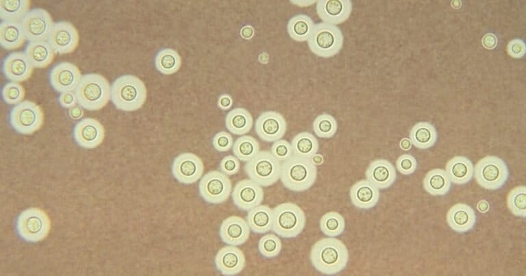 Study: Fighting Fungal Infections With Cannabinoids